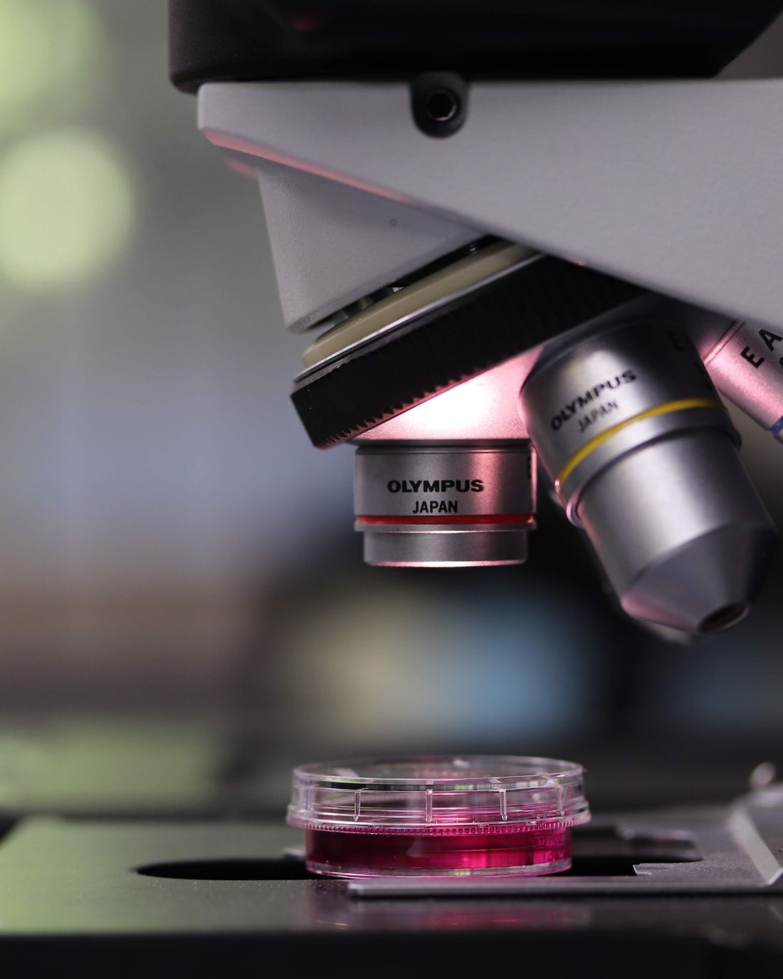 Extracellular vesicle and exosome research